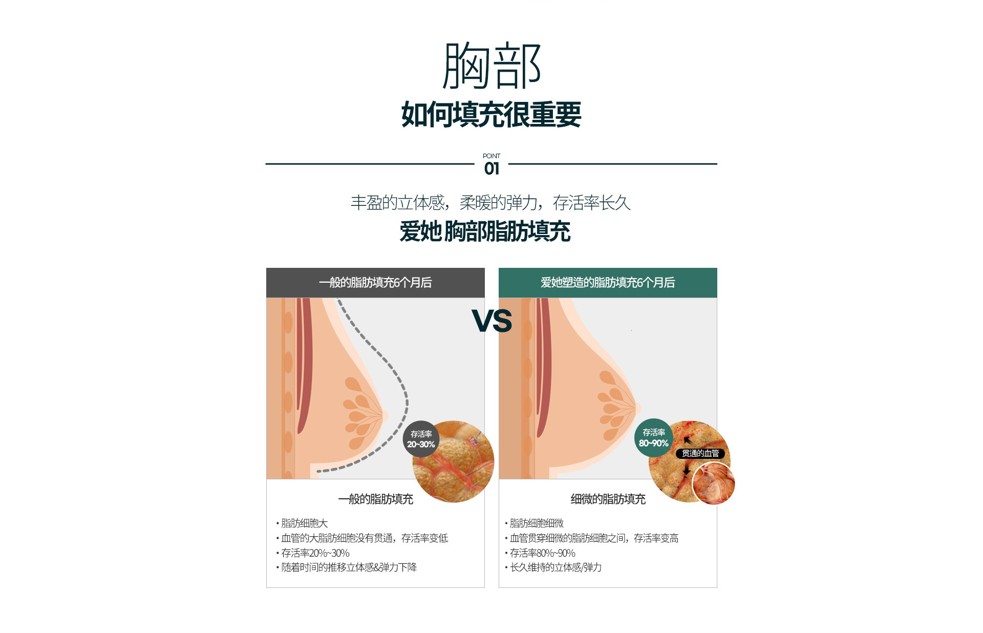 가슴지방이식