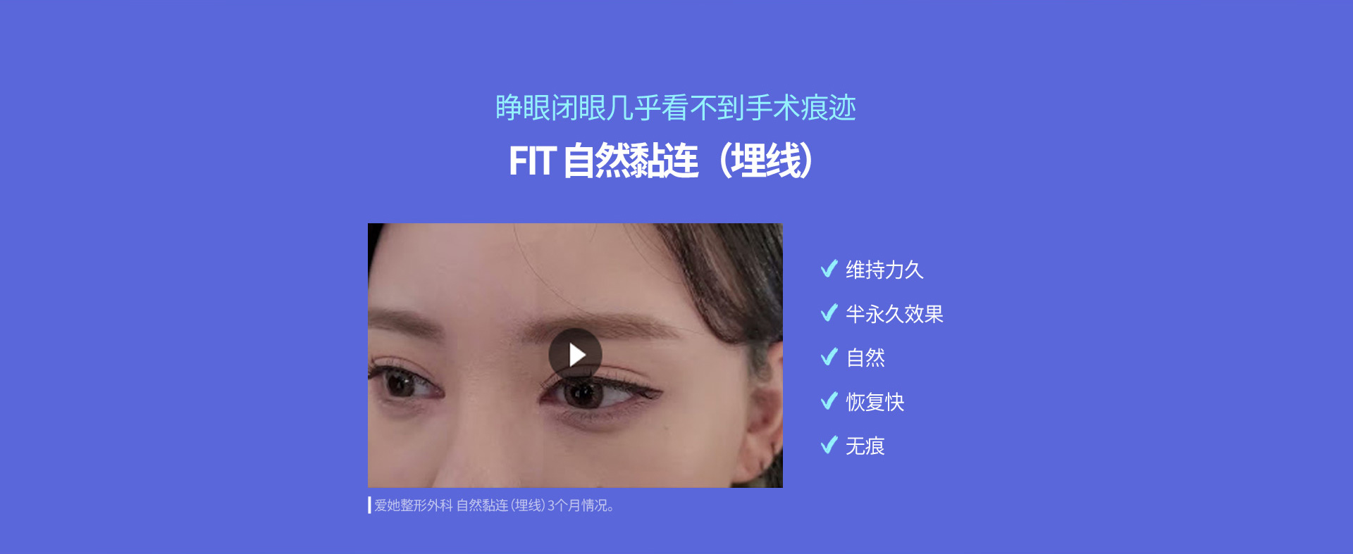 핏미 자연유착