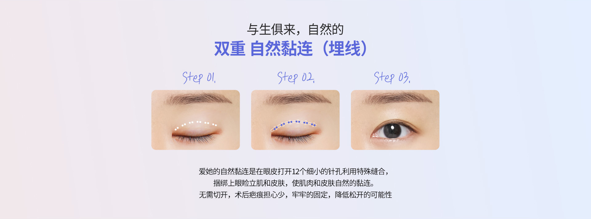 핏미 자연유착