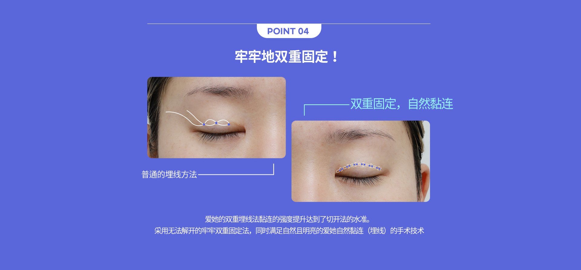 핏미 자연유착