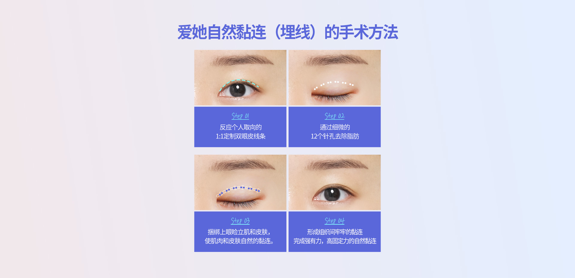 핏미 자연유착