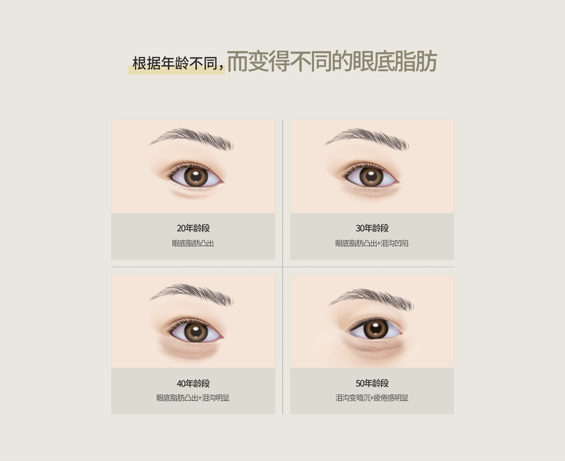 눈밑지방재배치/제거