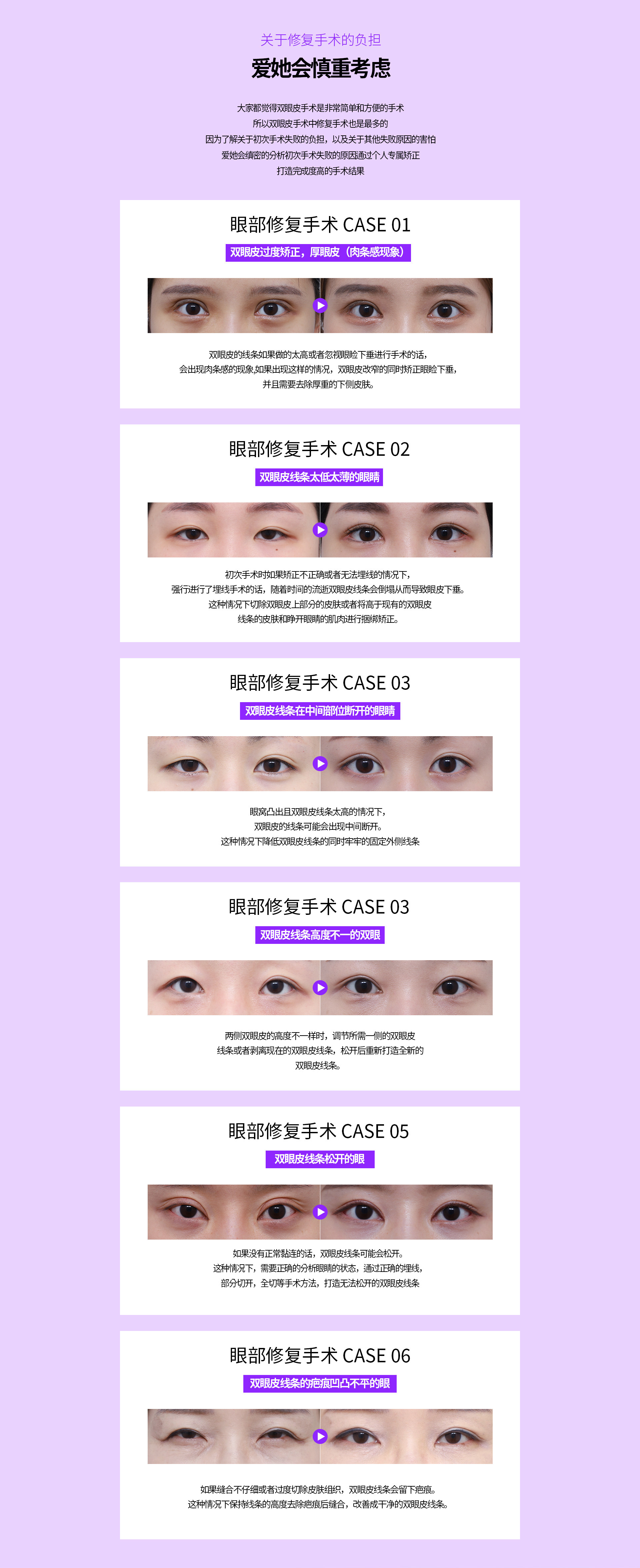눈재수술
