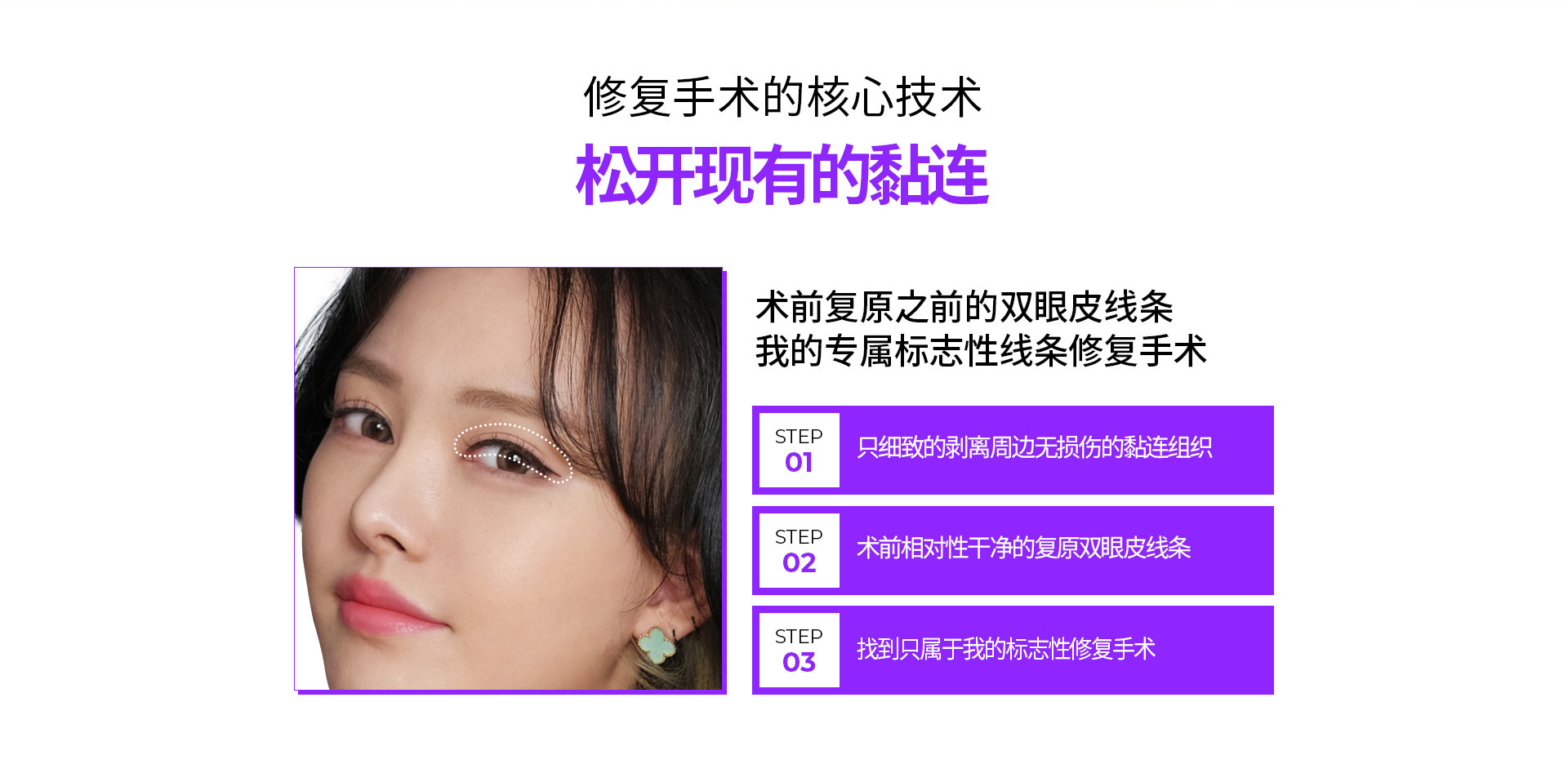 눈재수술