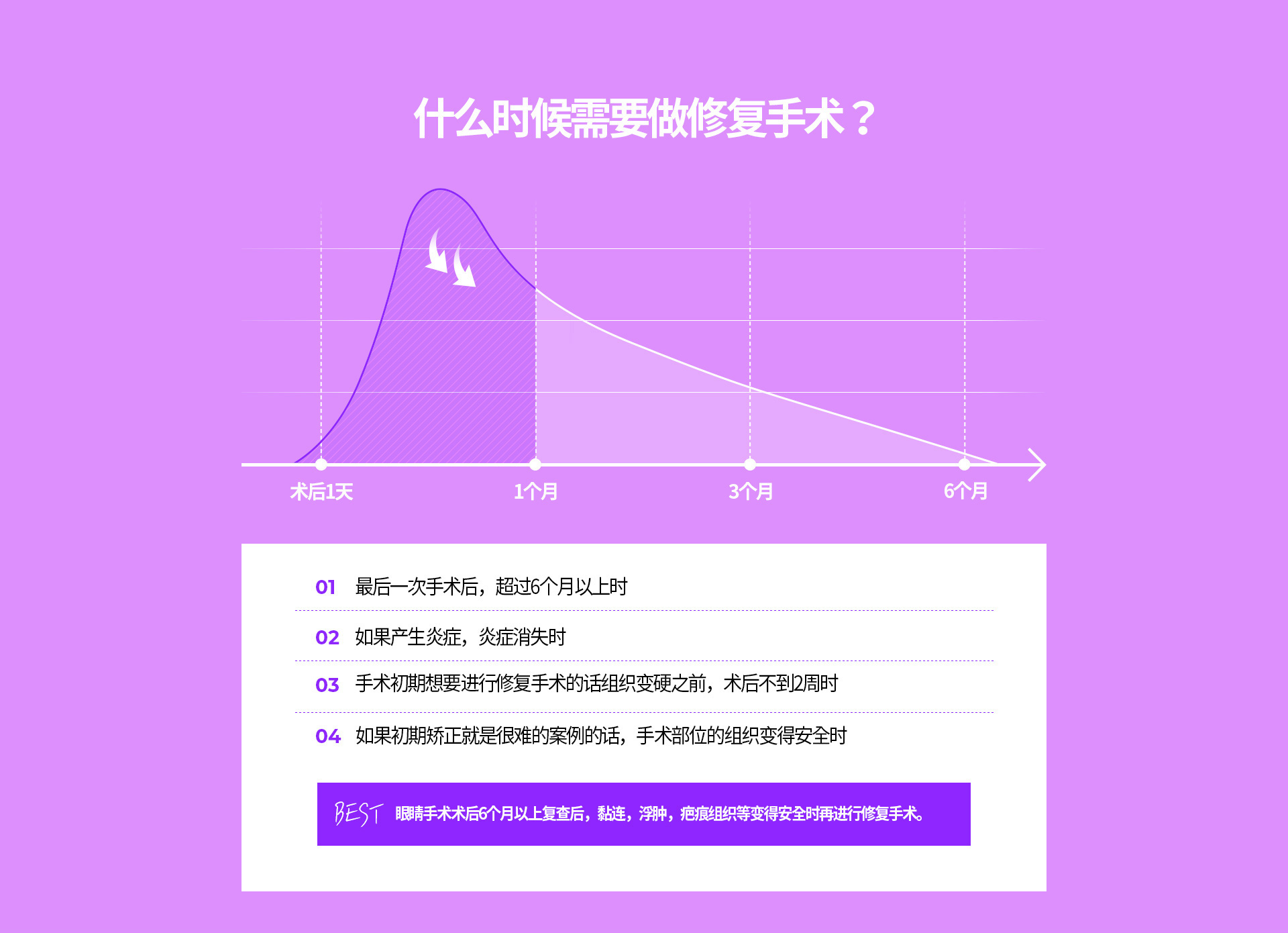 눈재수술