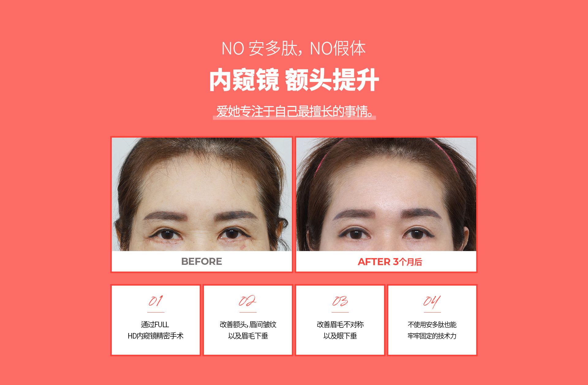 내시경 이마거상