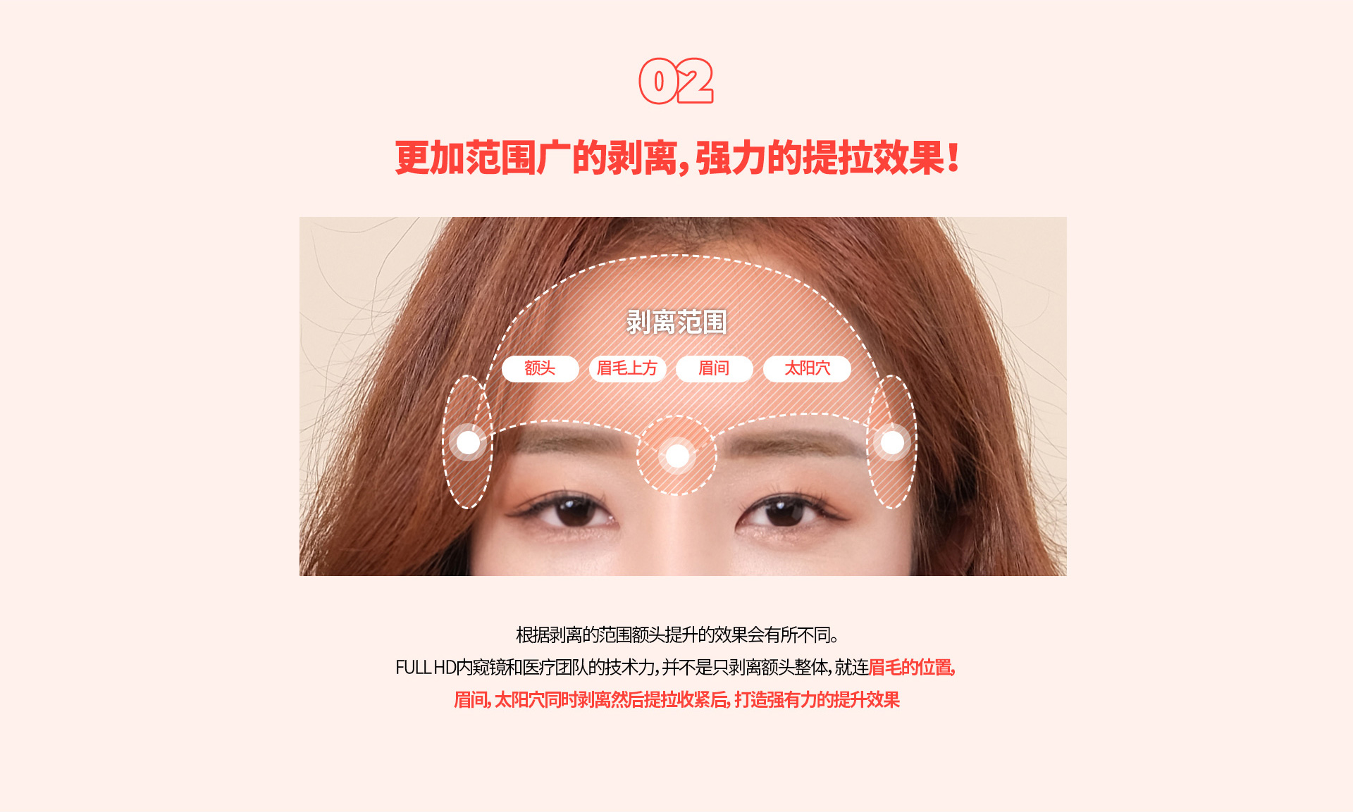 내시경 이마거상