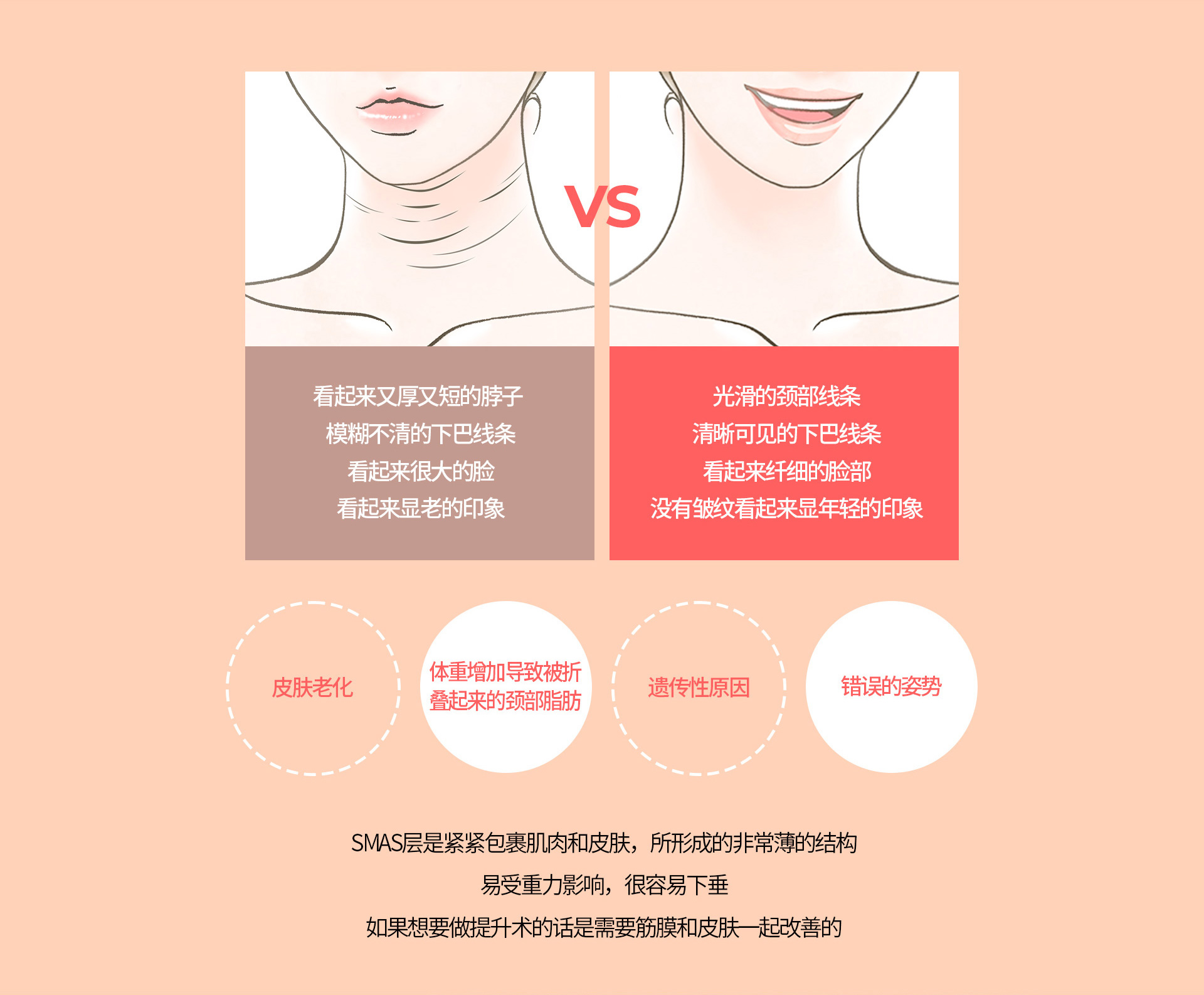 이중턱착붙리프팅