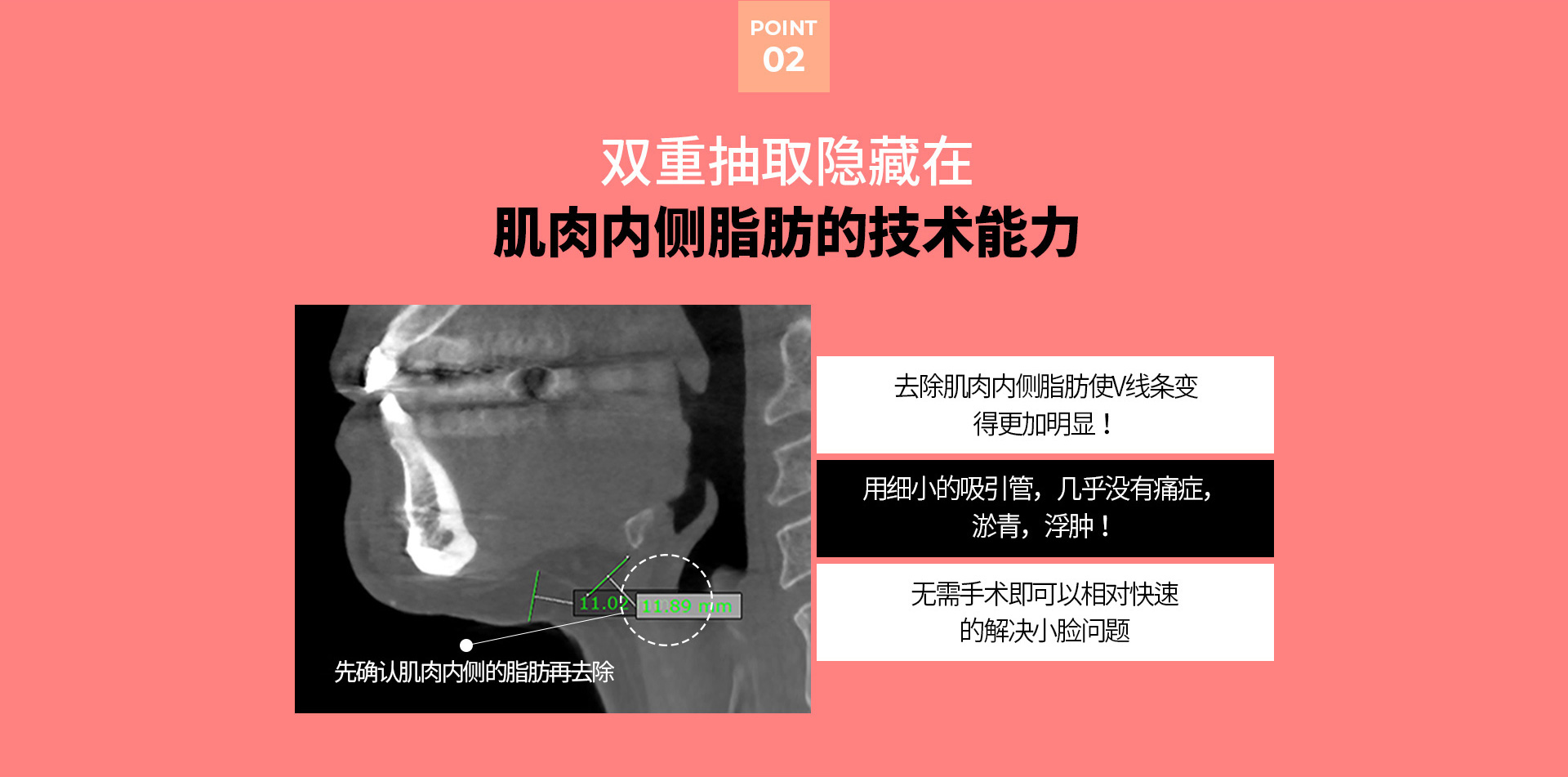 이중턱착붙리프팅