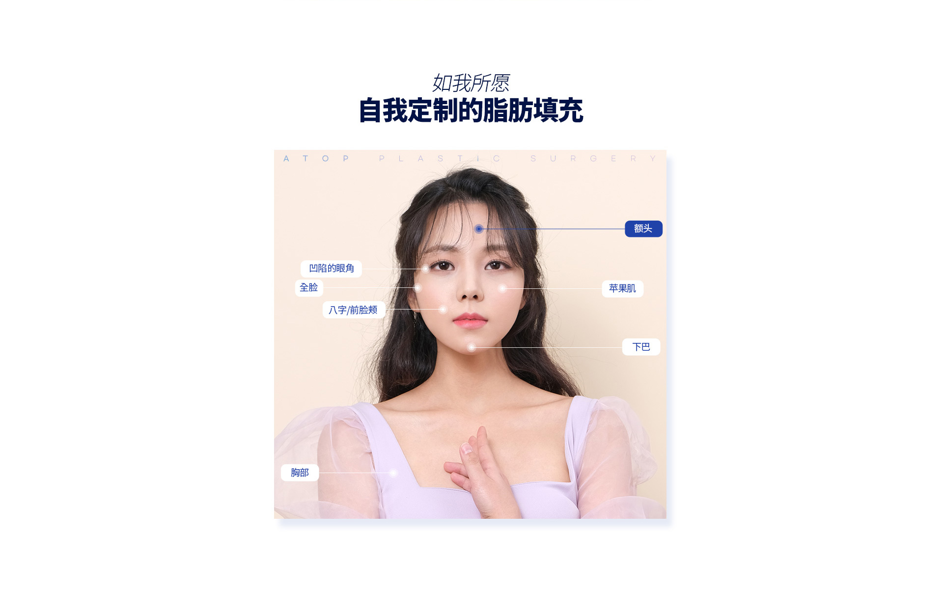 포인트지방이식