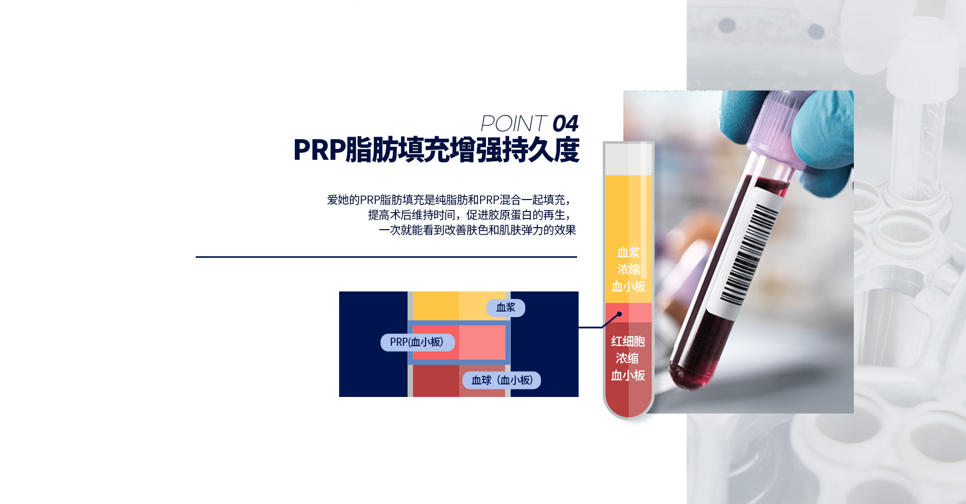포인트지방이식