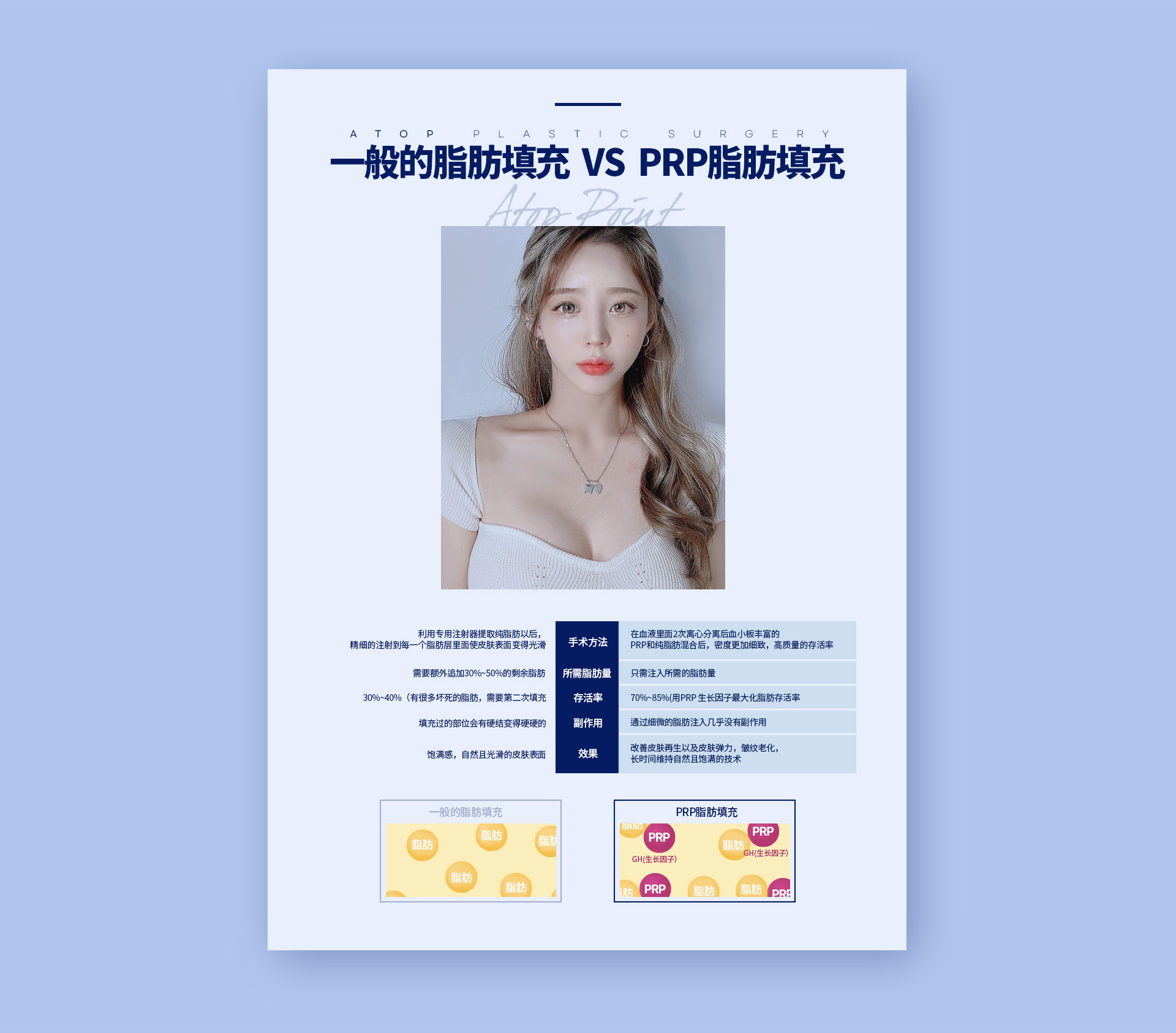 포인트지방이식