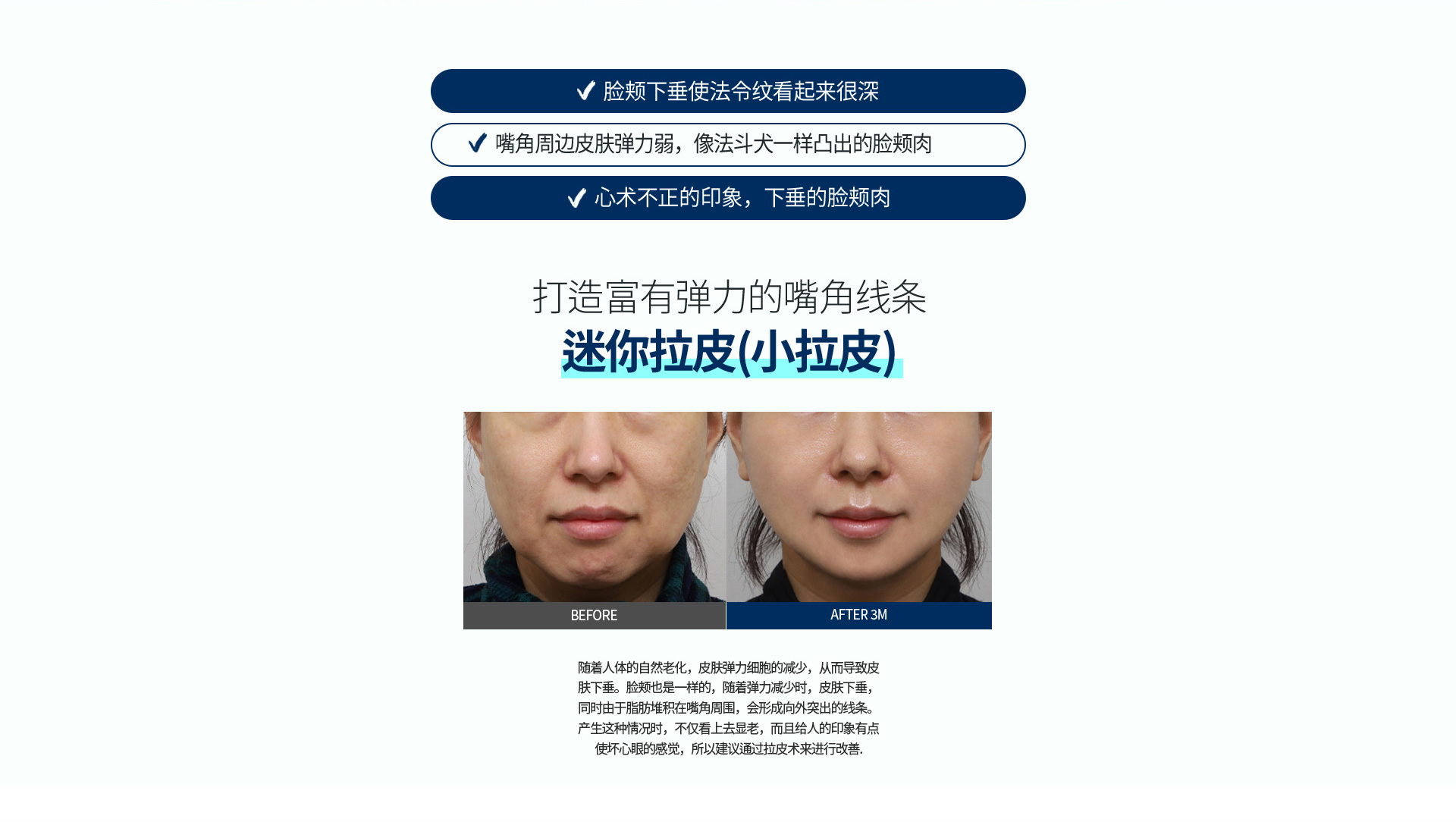 심술보리프팅