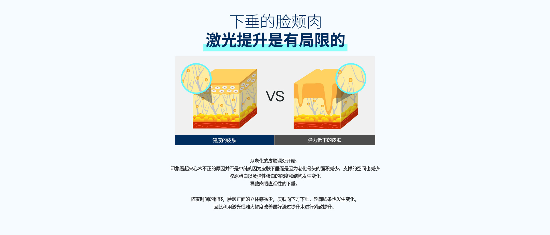 심술보리프팅