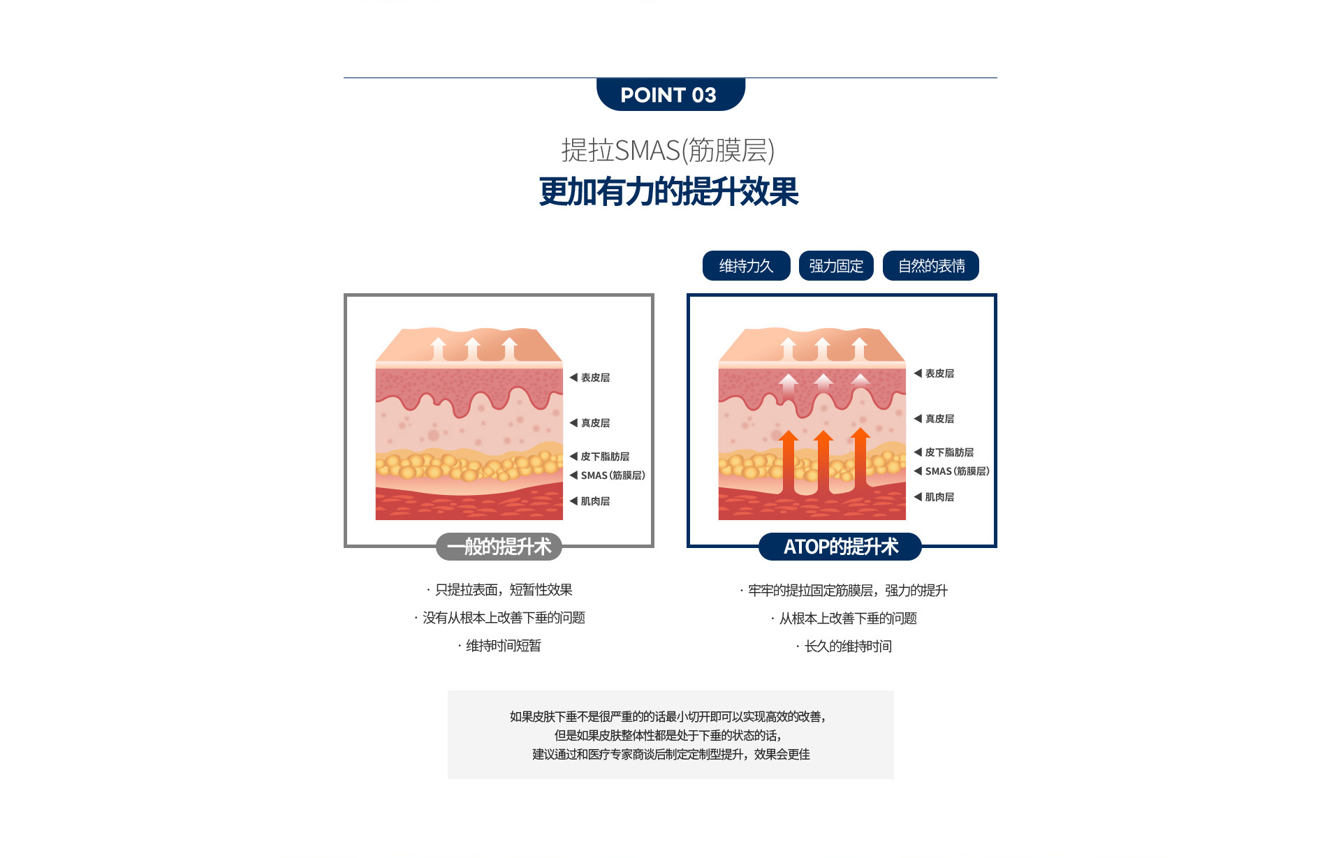심술보리프팅