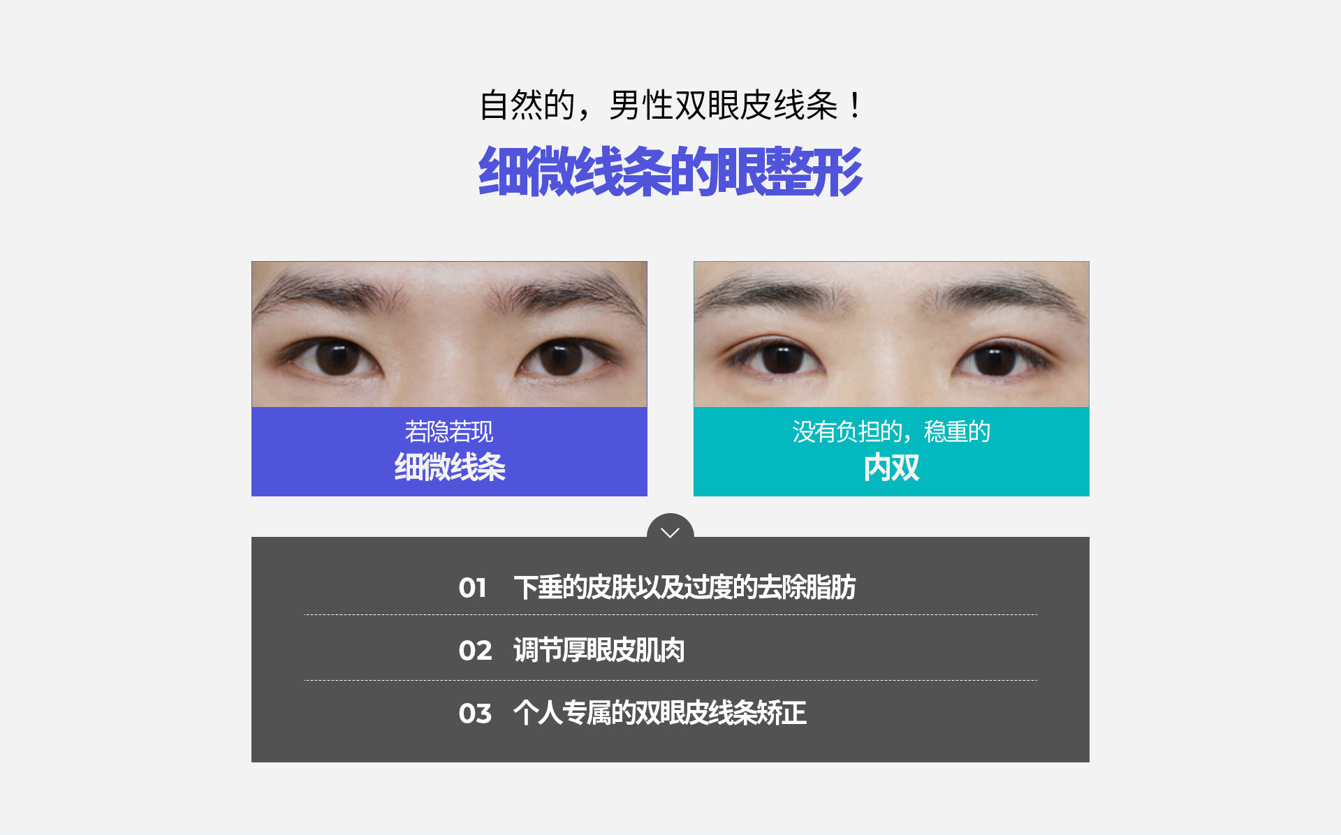 슬림라인 눈성형