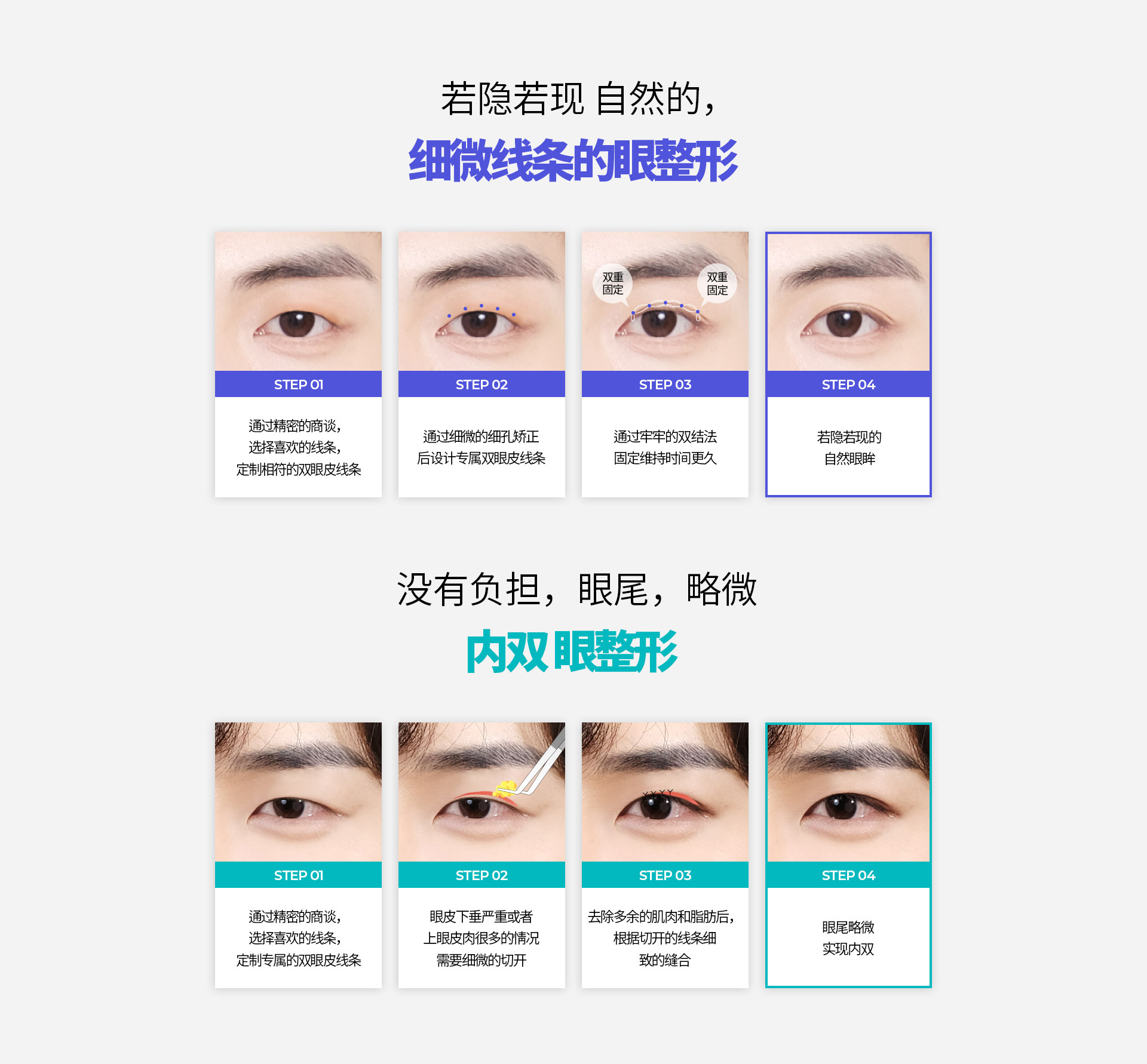 슬림라인 눈성형