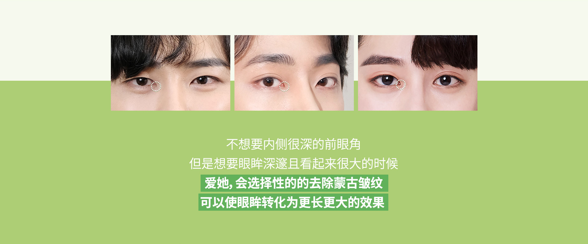 남자 트임성형