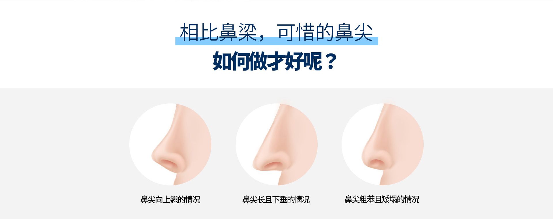 코끝성형