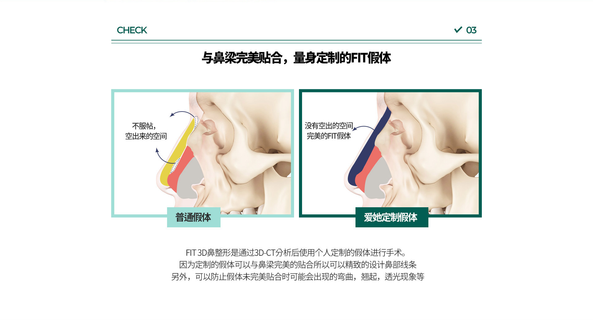 코재수술