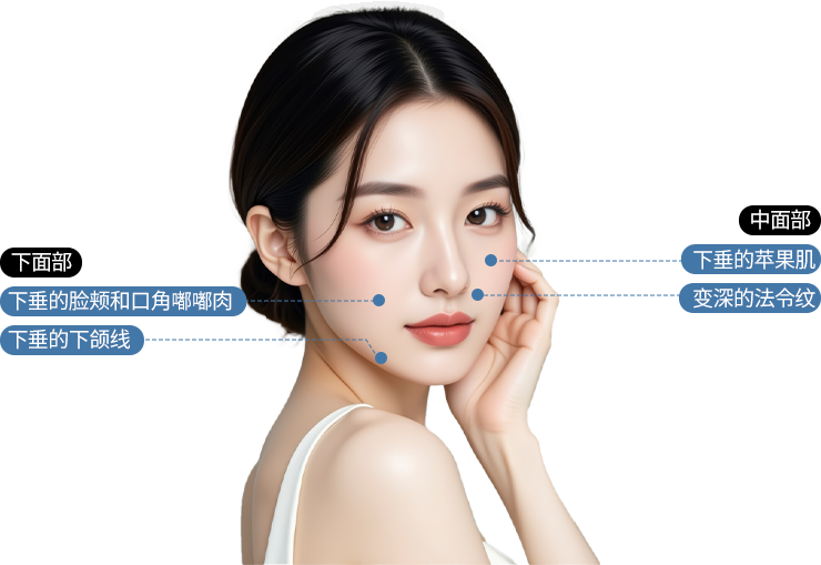 여우리프팅