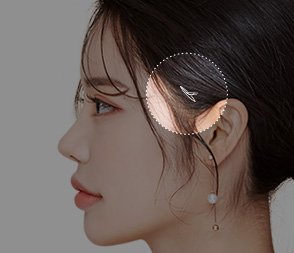 여우리프팅