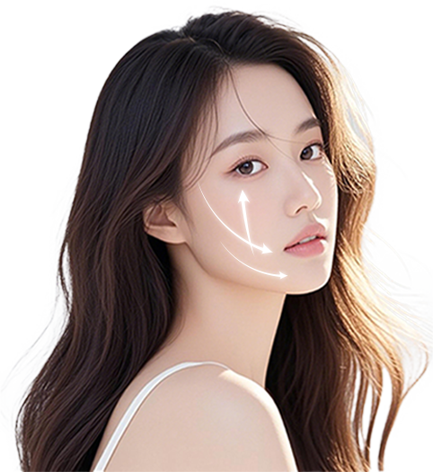 실리프팅